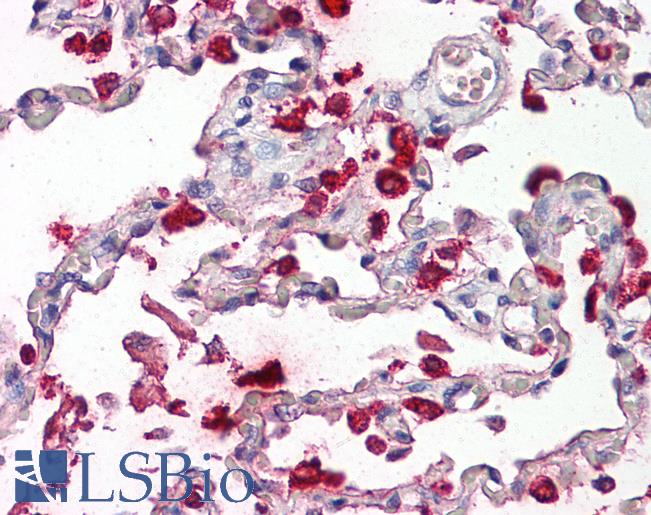 SFTPB / Surfactant Protein B Antibody - Anti-Surfactant Protein B / SP-B antibody IHC of human lung. Immunohistochemistry of formalin-fixed, paraffin-embedded tissue after heat-induced antigen retrieval. Antibody dilution 2.5-5 ug/ml. This image was taken for the unconjugated form of this product. Other forms have not been tested.