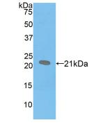 SFTPB / Surfactant Protein B Antibody