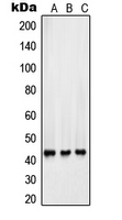 SFTPB / Surfactant Protein B Antibody - Western blot analysis of Surfactant Protein B expression in HepG2 (A); Y79 (B); A549 (C) whole cell lysates.