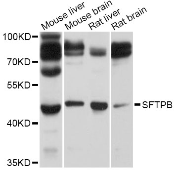 SFTPB / Surfactant Protein B Antibody - Western blot analysis of extracts of various cell lines, using SFTPB antibody at 1:1000 dilution. The secondary antibody used was an HRP Goat Anti-Rabbit IgG (H+L) at 1:10000 dilution. Lysates were loaded 25ug per lane and 3% nonfat dry milk in TBST was used for blocking. An ECL Kit was used for detection and the exposure time was 3s.