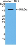 SFTPC / Surfactant Protein C Antibody - Western blot of SFTPC / Surfactant Protein C antibody.