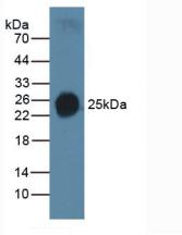 SFTPC / Surfactant Protein C Antibody - Western Blot; Sample: Human Serum.