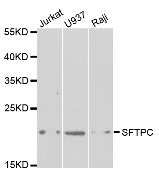 SFTPC / Surfactant Protein C Antibody - Western blot analysis of extracts of various cell lines.