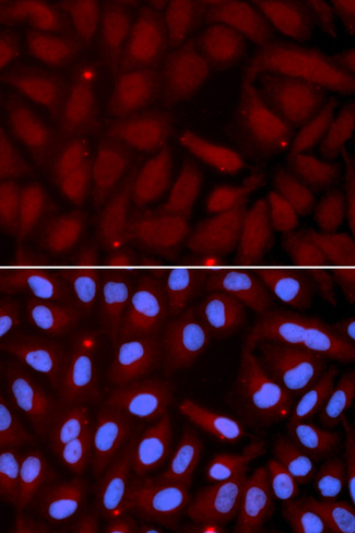 Anti-SFTPC / Surfactant Protein C Antibody | Rabbit anti-Human | LSBio