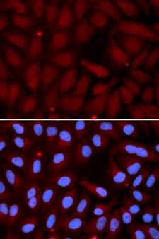 SFTPC / Surfactant Protein C Antibody - Immunofluorescence analysis of U2OS cells.