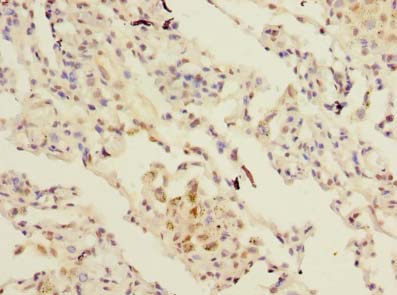 SFTPC / Surfactant Protein C Antibody - Immunohistochemistry of paraffin-embedded human lung tissue using antibody at dilution of 1:100.