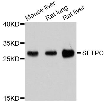 SFTPC / Surfactant Protein C Antibody - Western blot analysis of extracts of various cell lines, using SFTPC Antibody at 1:1000 dilution. The secondary antibody used was an HRP Goat Anti-Rabbit IgG (H+L) at 1:10000 dilution. Lysates were loaded 25ug per lane and 3% nonfat dry milk in TBST was used for blocking. An ECL Kit was used for detection and the exposure time was 30s.