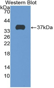 SFTPD / Surfactant Protein D Antibody - Western blot of recombinant SFTPD / Surfactant Protein D.