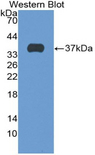 SFTPD / Surfactant Protein D Antibody - Western blot of recombinant SFTPD / Surfactant Protein D.