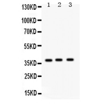 SFTPD / Surfactant Protein D Antibody - Surfactant protein D antibody Western blot. All lanes: Anti Surfactant protein D at 0.5 ug/ml. Lane 1: Rat Lung Tissue Lysate at 50 ug. Lane 2: Rat Brain Tissue Lysate at 50 ug. Lane 3: PANC Whole Cell Lysate at 40 ug. Predicted band size: 38 kD. Observed band size: 38 kD.