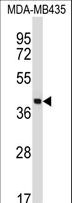 SFTPD / Surfactant Protein D Antibody - SFTPD Antibody western blot of MDA-MB435 cell line lysates (35 ug/lane). The SFTPD antibody detected the SFTPD protein (arrow).