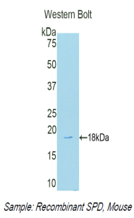 SFTPD / Surfactant Protein D Antibody - Western blot of recombinant SFTPD / Surfactant Protein D.  This image was taken for the unconjugated form of this product. Other forms have not been tested.