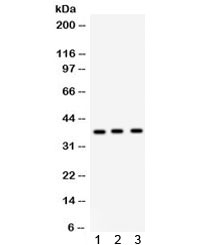 SFTPD / Surfactant Protein D Antibody