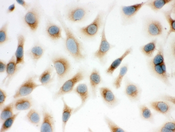 SFTPD / Surfactant Protein D Antibody - ICC testing of FFPE human HeLa cells with Surfactant protein D antibody. HIER: Boil the paraffin sections in pH 6, 10mM citrate buffer for 20 minutes and allow to cool prior to staining.