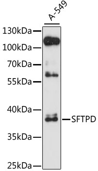 SFTPD / Surfactant Protein D Antibody - Western blot analysis of extracts of A-549 cells, using SFTPD antibody at 1:3000 dilution. The secondary antibody used was an HRP Goat Anti-Rabbit IgG (H+L) at 1:10000 dilution. Lysates were loaded 25ug per lane and 3% nonfat dry milk in TBST was used for blocking. An ECL Kit was used for detection and the exposure time was 30s.