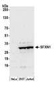 SFXN1 Antibody - Detection of human SFXN1 by western blot. Samples: Whole cell lysate (50 µg) from HeLa, HEK293T, and Jurkat cells prepared using NETN lysis buffer. Antibody: Affinity purified rabbit anti-SFXN1 antibody used for WB at 0.4 µg/ml. Detection: Chemiluminescence with an exposure time of 30 seconds.