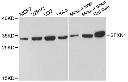 SFXN1 Antibody - Western blot analysis of extracts of various cell lines, using SFXN1 antibody at 1:3000 dilution. The secondary antibody used was an HRP Goat Anti-Rabbit IgG (H+L) at 1:10000 dilution. Lysates were loaded 25ug per lane and 3% nonfat dry milk in TBST was used for blocking. An ECL Kit was used for detection and the exposure time was 90s.