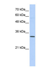 SFXN1 Antibody - SFXN1 antibody Western blot of Transfected 293T cell lysate. This image was taken for the unconjugated form of this product. Other forms have not been tested.
