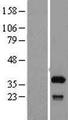 SFXN1 Protein - Western validation with an anti-DDK antibody * L: Control HEK293 lysate R: Over-expression lysate