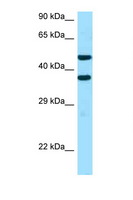 SFXN2 Antibody - SFXN2 antibody Western blot of H226 Cell lysate. Antibody concentration 1 ug/ml.  This image was taken for the unconjugated form of this product. Other forms have not been tested.