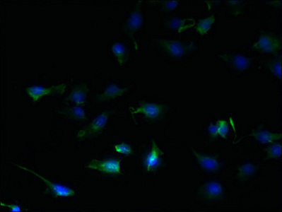 SFXN2 Antibody - Immunofluorescent analysis of U251 cells using SFXN2 Antibody at dilution of 1:100 and Alexa Fluor 488-congugated AffiniPure Goat Anti-Rabbit IgG(H+L)