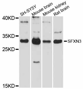 SFXN3 / Sideroflexin 3 Antibody - Western blot analysis of extracts of various cell lines, using SFXN3 antibody at 1:1000 dilution. The secondary antibody used was an HRP Goat Anti-Rabbit IgG (H+L) at 1:10000 dilution. Lysates were loaded 25ug per lane and 3% nonfat dry milk in TBST was used for blocking. An ECL Kit was used for detection and the exposure time was 10s.