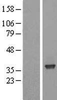 SFXN3 / Sideroflexin 3 Protein - Western validation with an anti-DDK antibody * L: Control HEK293 lysate R: Over-expression lysate