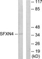 SFXN4 Antibody - Western blot analysis of lysates from HUVEC cells, using SFXN4 Antibody. The lane on the right is blocked with the synthesized peptide.