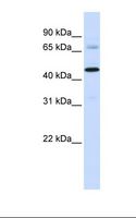 SFXN4 Antibody - MCF7 cell lysate. Antibody concentration: 1.0 ug/ml. Gel concentration: 12%.  This image was taken for the unconjugated form of this product. Other forms have not been tested.