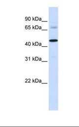 SFXN4 Antibody - MCF7 cell lysate. Antibody concentration: 1.0 ug/ml. Gel concentration: 12%.  This image was taken for the unconjugated form of this product. Other forms have not been tested.