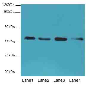 SFXN4 Antibody - Western blot. All lanes: SFXN4 antibody at 0.3 ug/ml. Lane 1: K562 whole cell lysate. Lane 2: U251 whole cell lysate. Lane 3: U87 whole cell lysate. Lane 4: A549 whole cell lysate. Secondary Goat polyclonal to Rabbit IgG at 1:10000 dilution. Predicted band size: 38 kDa. Observed band size: 38 kDa.