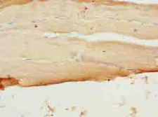 SFXN4 Antibody - Immunohistochemistry of paraffin-embedded human skeletal muscle tissue using antibody at dilution of 1:100.