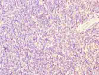 SFXN4 Antibody - Immunohistochemistry of paraffin-embedded human thymus tissue using antibody at dilution of 1:100.