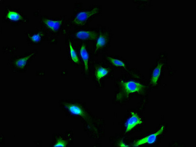 SFXN4 Antibody - Immunofluorescent analysis of U251 cells using SFXN4 Antibody at dilution of 1:100 and Alexa Fluor 488-congugated AffiniPure Goat Anti-Rabbit IgG(H+L)