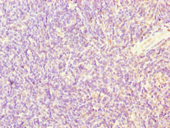 SFXN4 Antibody - Immunohistochemistry of paraffin-embedded human thymus tissue using SFXN4 Antibody at dilution of 1:100