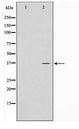 SFXN4 Antibody - Western blot of HUVEC cell lysate using SFXN4 Antibody