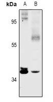 SFXN4 Antibody - Western blot analysis of SFXN4 expression in HEK293T (A), DLD (B) whole cell lysates.