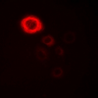 SFXN4 Antibody - Immunofluorescent analysis of SFXN4 staining in COS7 cells. Formalin-fixed cells were permeabilized with 0.1% Triton X-100 in TBS for 5-10 minutes and blocked with 3% BSA-PBS for 30 minutes at room temperature. Cells were probed with the primary antibody in 3% BSA-PBS and incubated overnight at 4 °C in a hidified chamber. Cells were washed with PBST and incubated with Alexa Fluor 647-conjugated secondary antibody (red) in PBS at room temperature in the dark.