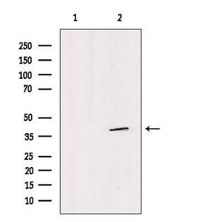 SFXN4 Antibody - Western blot analysis of extracts of HepG2 cells using SFXN4 antibody. Lane 1 was treated with the antigen-specific peptide.