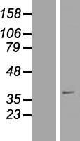 SFXN4 Protein - Western validation with an anti-DDK antibody * L: Control HEK293 lysate R: Over-expression lysate