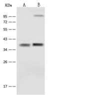 SFXN5 / Sideroflexin 5 Antibody - Anti-SFXN5 rabbit polyclonal antibody at 1:500 dilution. Lane A: Mouse kidney tissue lysate. Lane B: Mouse brain tissue lysate. Lysates/proteins at 30 ug per lane. Secondary: Goat Anti-Rabbit IgG (H+L)/HRP at 1/10000 dilution. Developed using the ECL technique. Performed under reducing conditions. Predicted band size: 37 kDa.