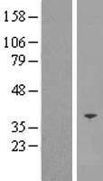 SFXN5 / Sideroflexin 5 Protein - Western validation with an anti-DDK antibody * L: Control HEK293 lysate R: Over-expression lysate