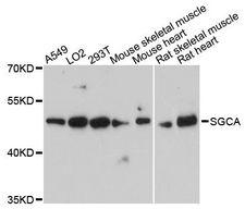 SGCA / DAG2 Antibody - Western blot analysis of extracts of various cell lines, using SGCA antibody at 1:3000 dilution. The secondary antibody used was an HRP Goat Anti-Rabbit IgG (H+L) at 1:10000 dilution. Lysates were loaded 25ug per lane and 3% nonfat dry milk in TBST was used for blocking. An ECL Kit was used for detection and the exposure time was 90s.