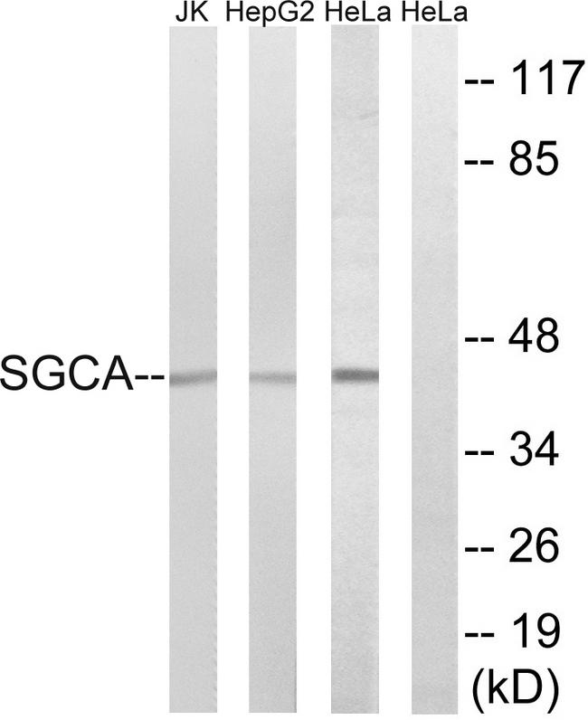 SGCA / DAG2 Antibody - Western blot analysis of extracts from Jurkat cells, HepG2 cells and HeLa cells, using SGCA antibody.