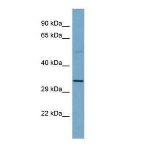 SGCB / SGC / Sarcoglycan Beta Antibody - Western blot of Human Fetal Small Intestine. SGCB antibody dilution 1.0 ug/ml.  This image was taken for the unconjugated form of this product. Other forms have not been tested.