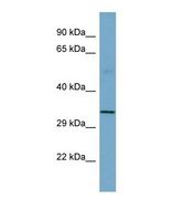 SGCB / SGC / Sarcoglycan Beta Antibody - Western blot of Human Fetal Small Intestine. SGCB antibody dilution 1.0 ug/ml.  This image was taken for the unconjugated form of this product. Other forms have not been tested.