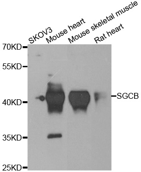 SGCB / SGC / Sarcoglycan Beta Antibody - Western blot analysis of extracts of various cell lines.