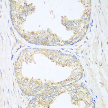 SGCB / SGC / Sarcoglycan Beta Antibody - Immunohistochemistry of paraffin-embedded human prostate.
