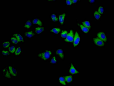 SGCB / SGC / Sarcoglycan Beta Antibody - Immunofluorescence staining of Hela cells diluted at 1:200, counter-stained with DAPI. The cells were fixed in 4% formaldehyde, permeabilized using 0.2% Triton X-100 and blocked in 10% normal Goat Serum. The cells were then incubated with the antibody overnight at 4°C.The Secondary antibody was Alexa Fluor 488-congugated AffiniPure Goat Anti-Rabbit IgG (H+L).