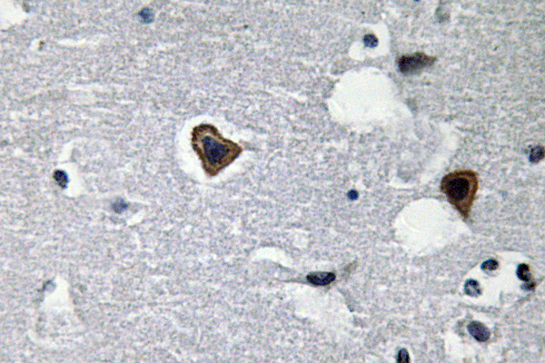 SGCB / SGC / Sarcoglycan Beta Antibody - IHC of Sarcoglycan- (V136) pAb in paraffin-embedded human brain tissue.